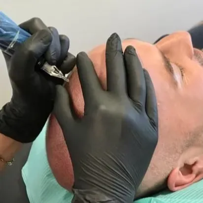 Image de Micropigmentation capillaire