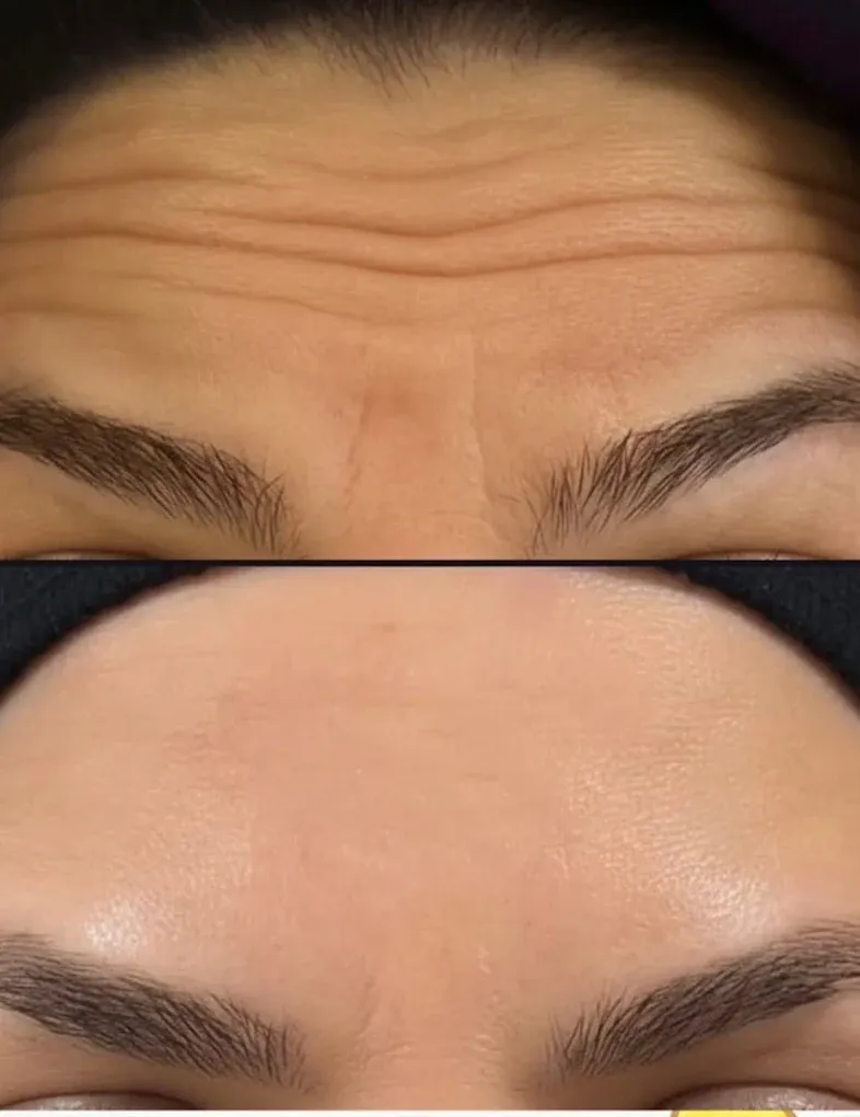 Clinical facial aesthetics and contouring procedure