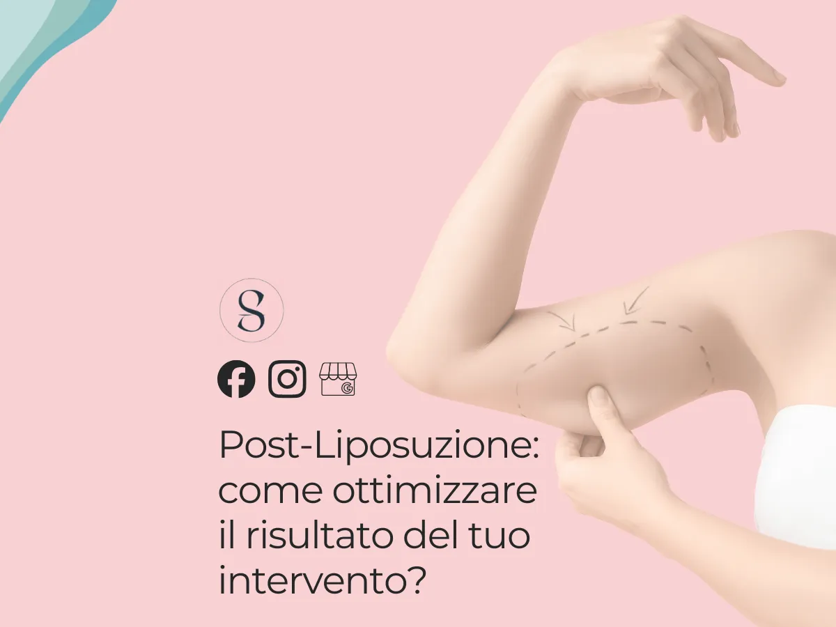 Hai fatto un intervento di liposuzione o liposcultura?