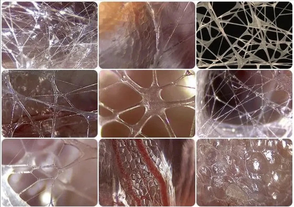 какво е фасция?