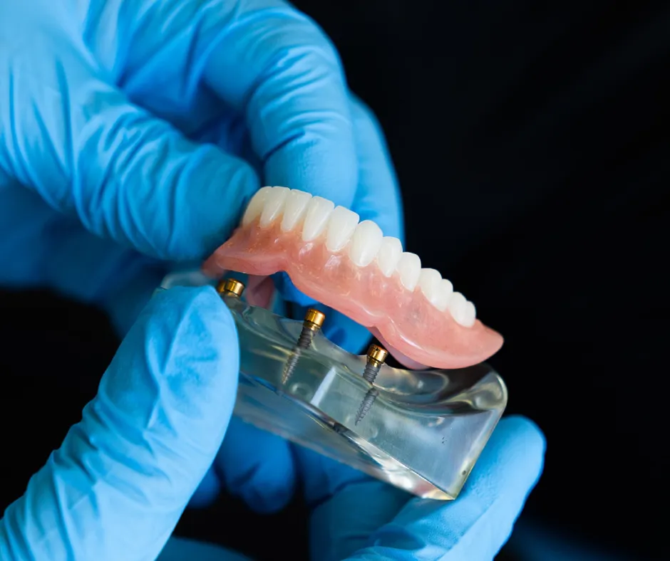 Dentures in Kitchener