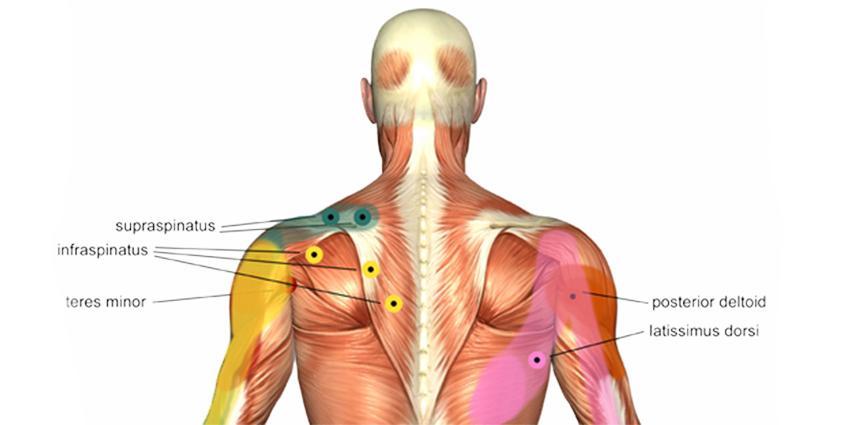 Frozen Shoulder & Bursitis
