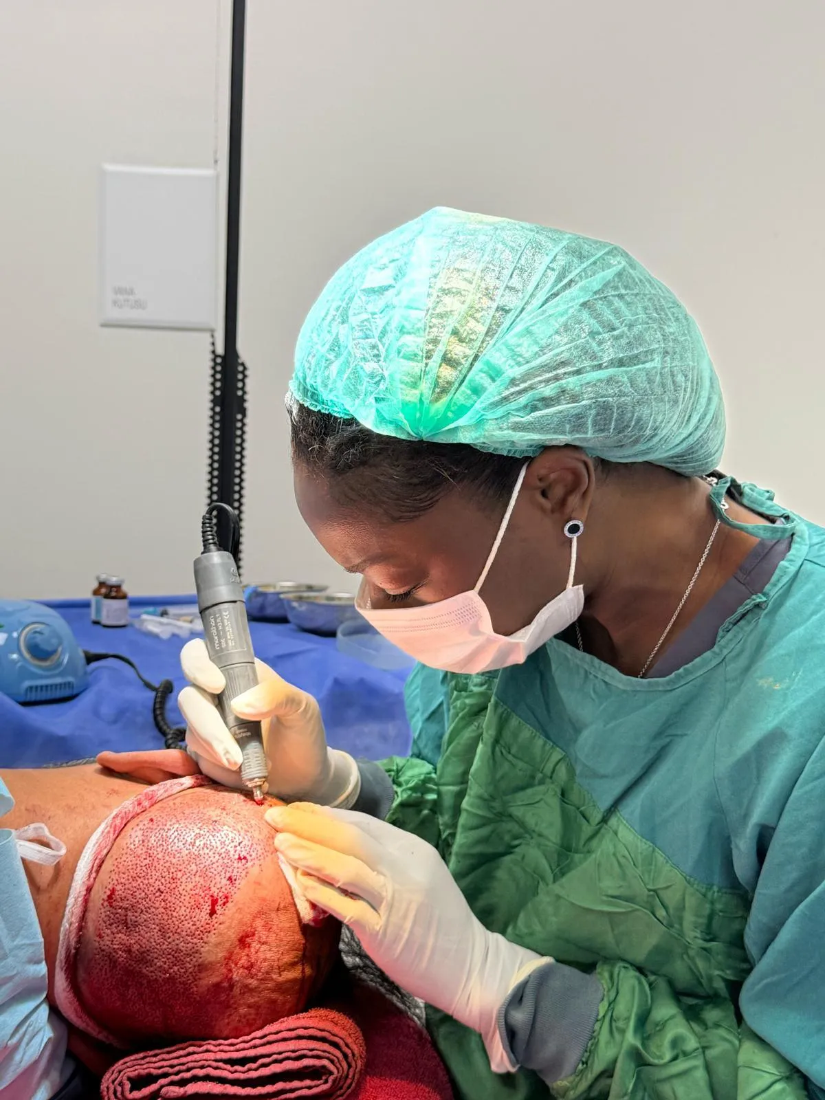 hair loss consultation