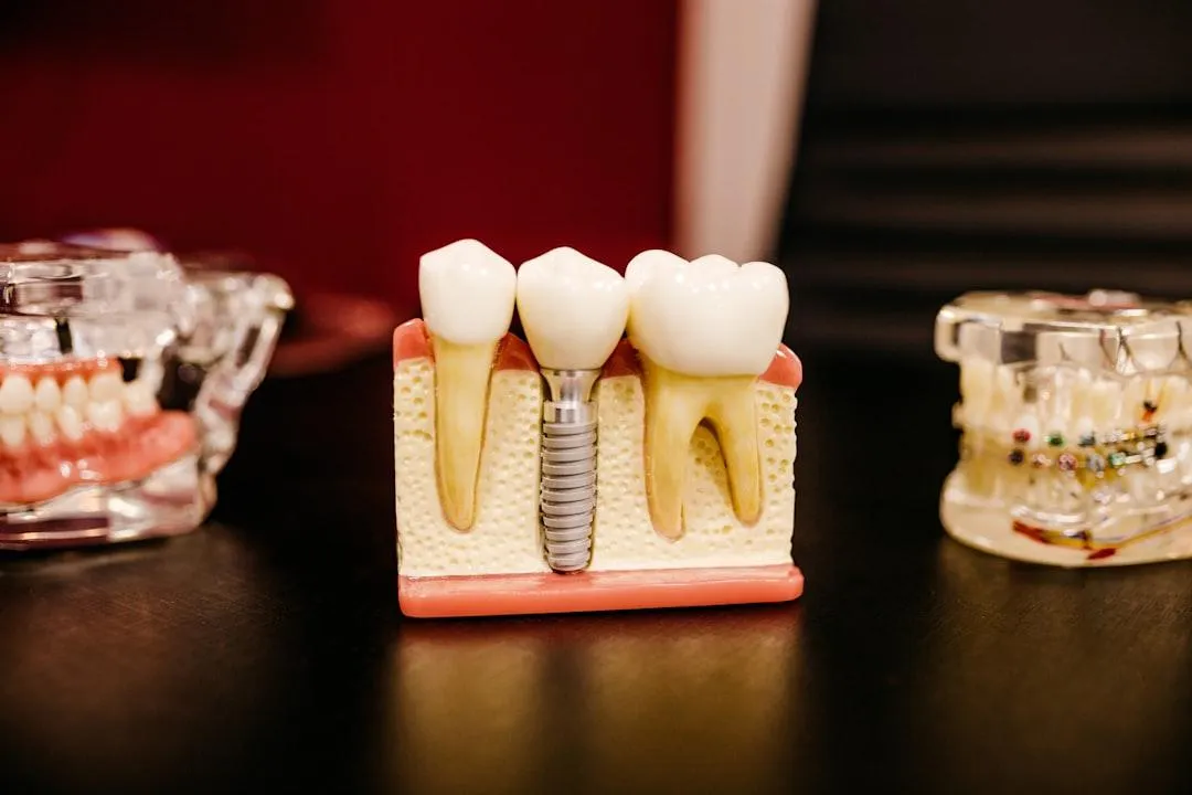 comparison of a dental implant, a fixed bridge, and a removable partial denture