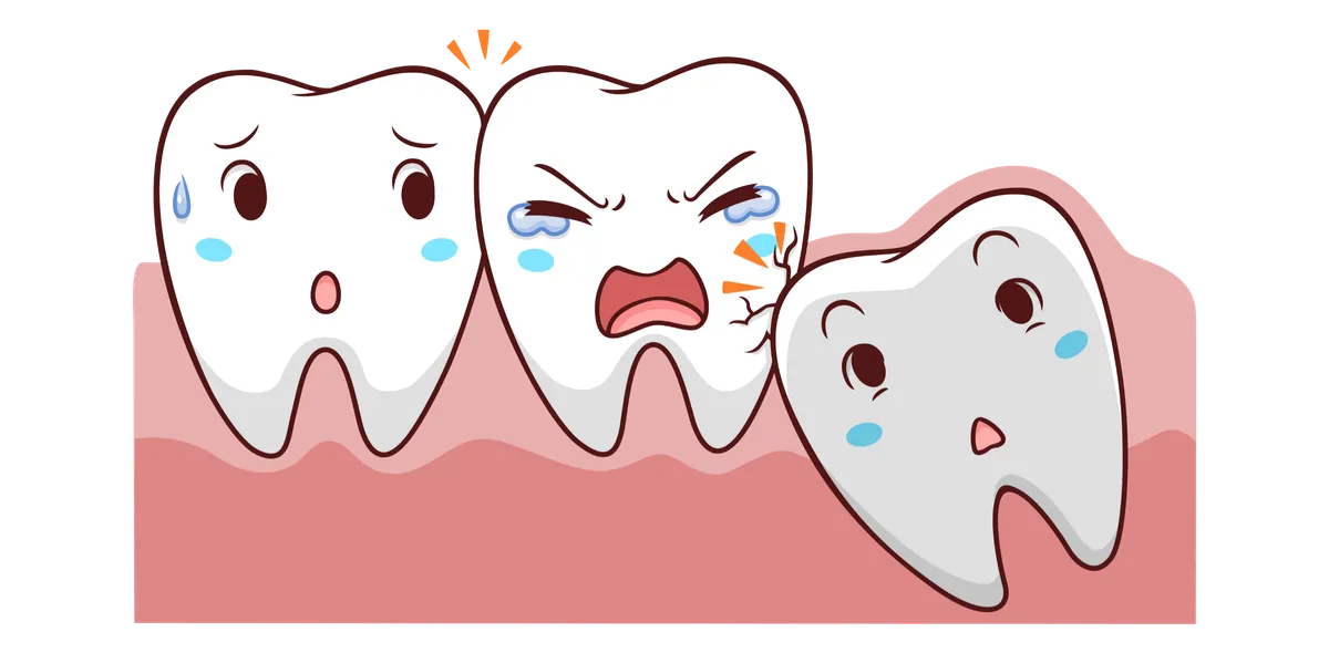 Cartoon illustration of three teeth in gums. The middle tooth looks in pain and is being pushed by a slanted wisdom tooth, while the left tooth looks worried and the wisdom tooth appears apologetic.