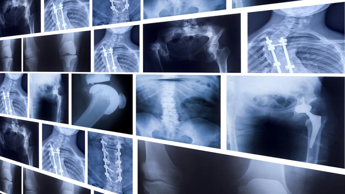 A collection of X-rays showing various body parts and conditions