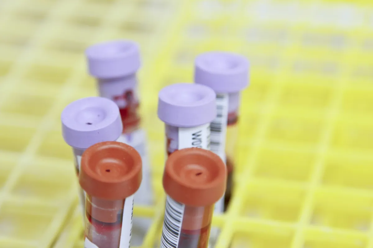 E51 Your Blood Work Has A Cancer Marker Hiding In Plain Sight