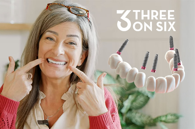 Smiling woman with 3 on 6 dental implants