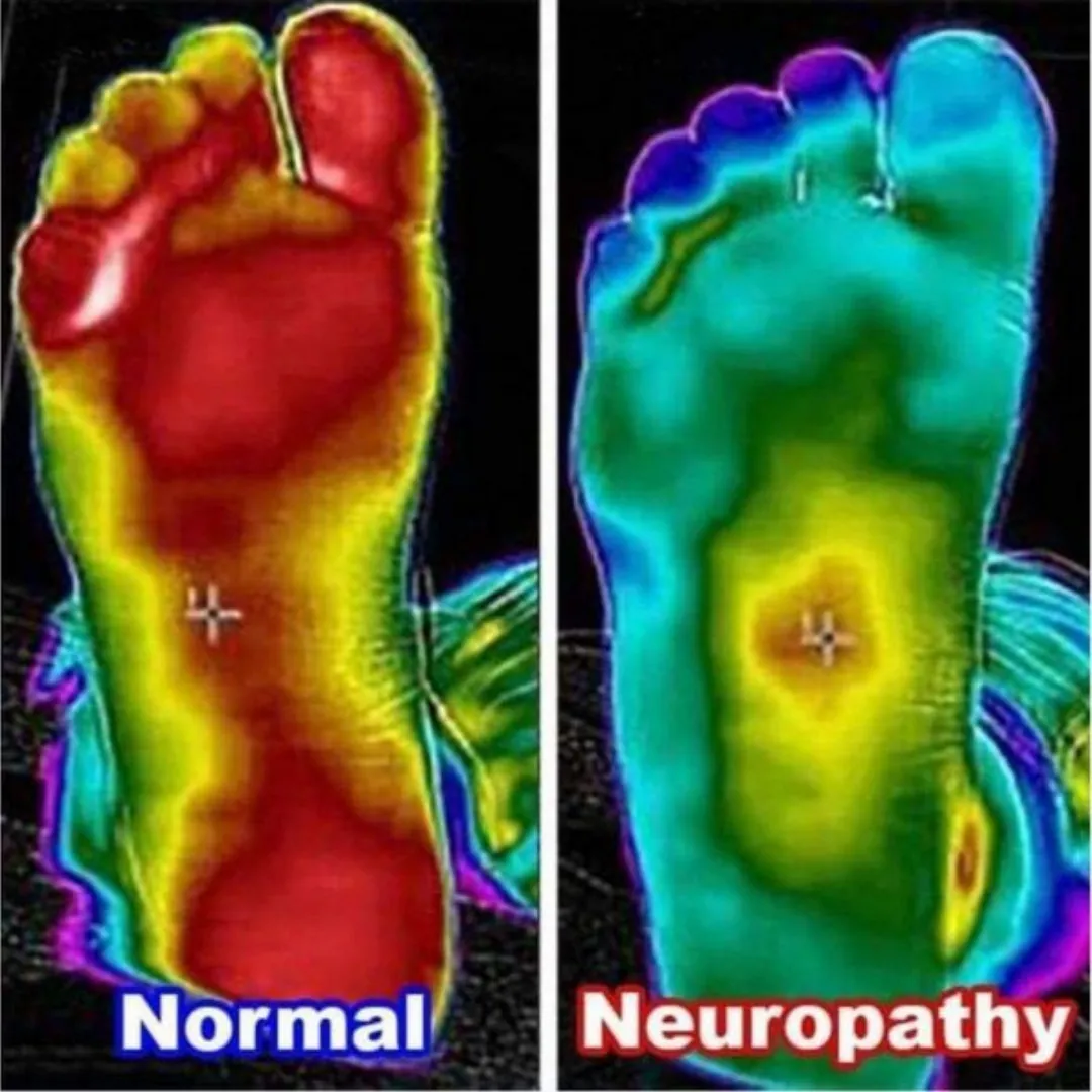 free-neuropathy-consultation