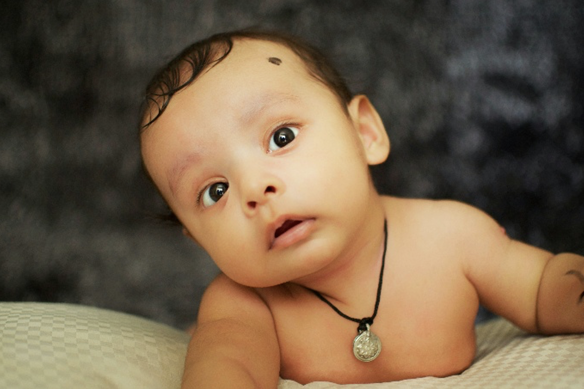 Plagiocephaly (flat head) in babies: Why Early Attention Matters