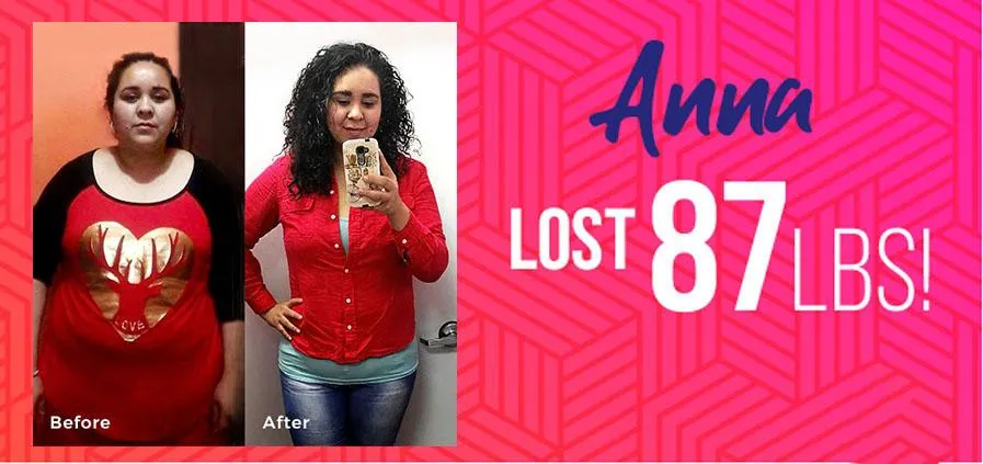 MetaVive Weight Loss, Anna lost 87 pounds