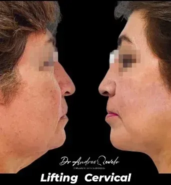 Clínica de cirugía facial Dr. Revelo