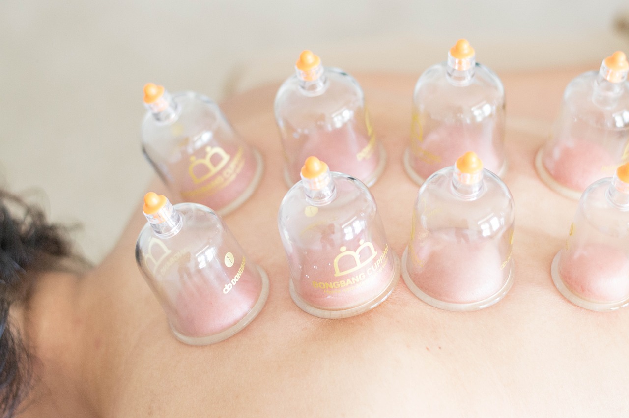 massage therapy cupping alton illinoi