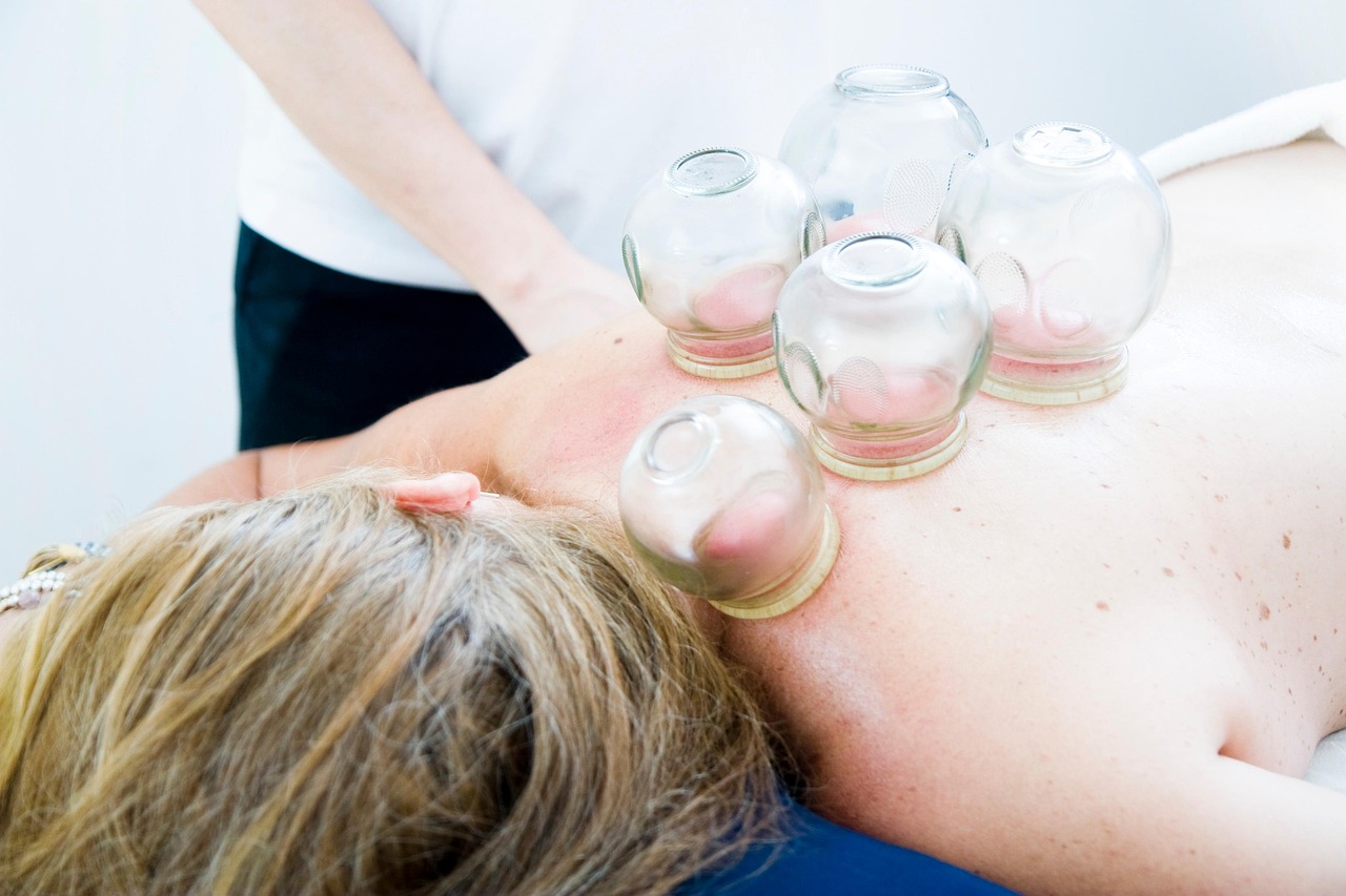 cupping on a massage therapy patient