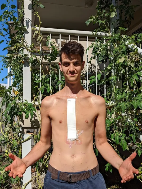 Cancer Recovery in Tweed Heads