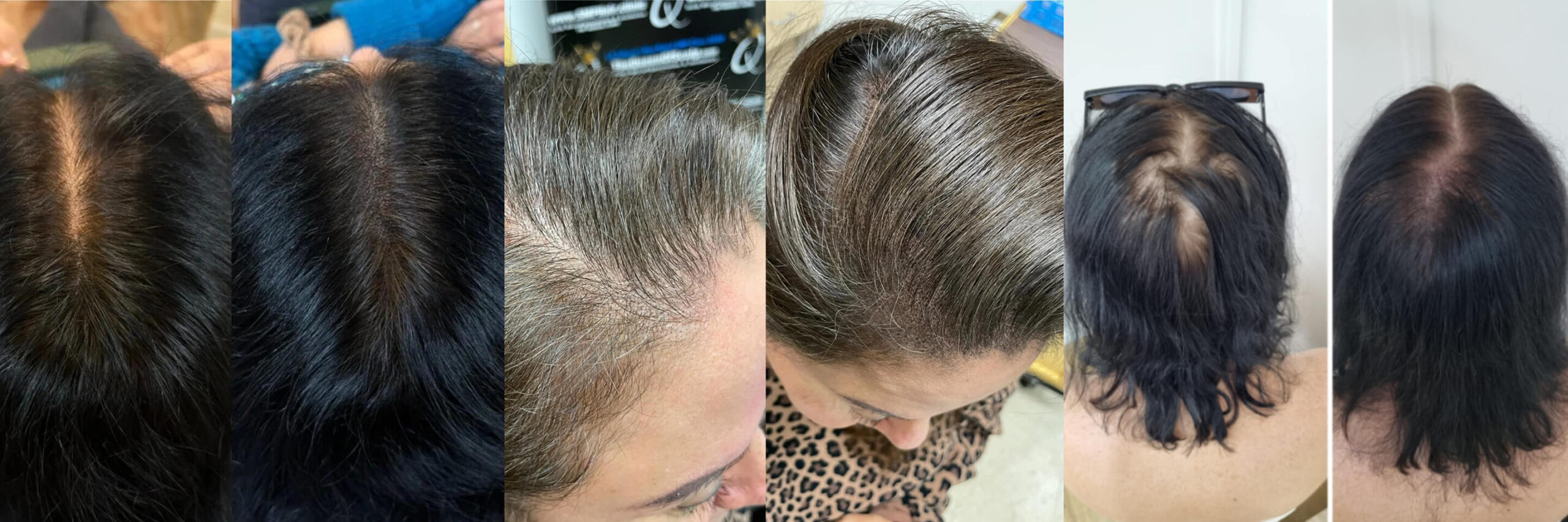 a body of water with trees in it