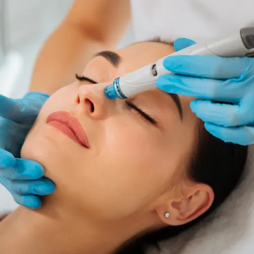 Hydrafacial kezelést bemutató kép