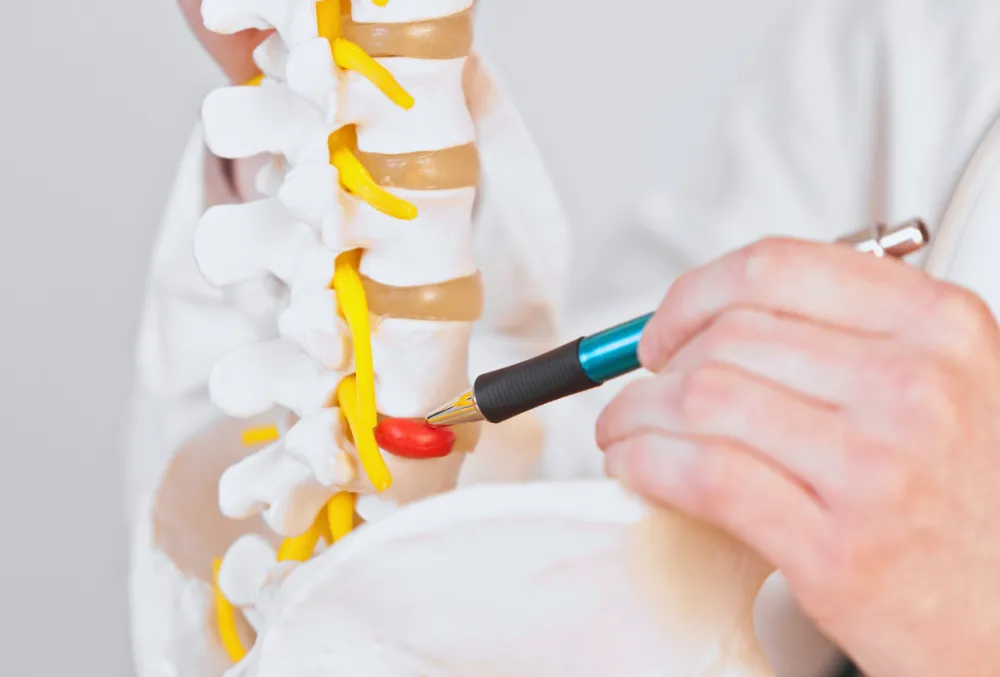 Showing a herniated lumbar disc compressing a nerve in the spine. Linked icons illustrate pain while lifting, limited mobility, and discomfort during prolonged sitting. Clear labels and a modern design emphasize the impact of disc herniation on daily life