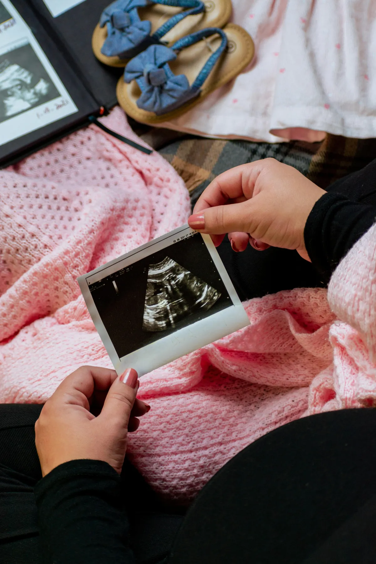 Parents looking at their baby's ultrasound scan