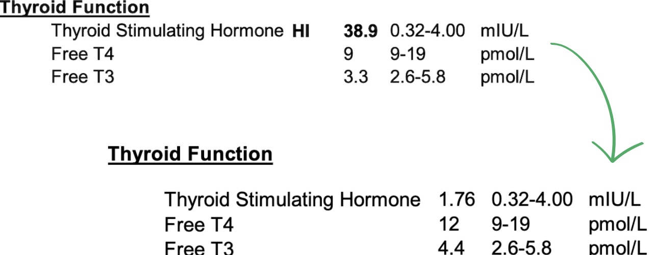 A thyroid function lab comparison showing TSH dropping from a high 38.9 to an optimal 1.76, with Free T4 and Free T3 levels moving into optimal ranges after following the Heal My Thyroid Blueprint.