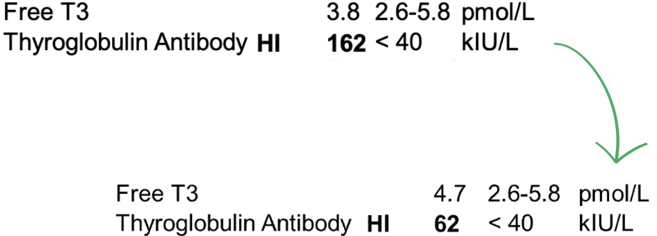 Thyroid lab comparison showing Free T3 increasing to an optimal 4.7 and Thyroglobulin Antibodies significantly decreasing from 162 to 62, demonstrating rapid progress toward remission.