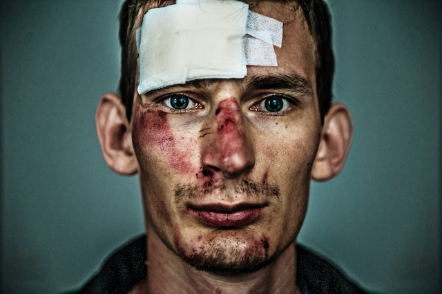 a person with a bandage on his forehead claiming personal injury  settlement