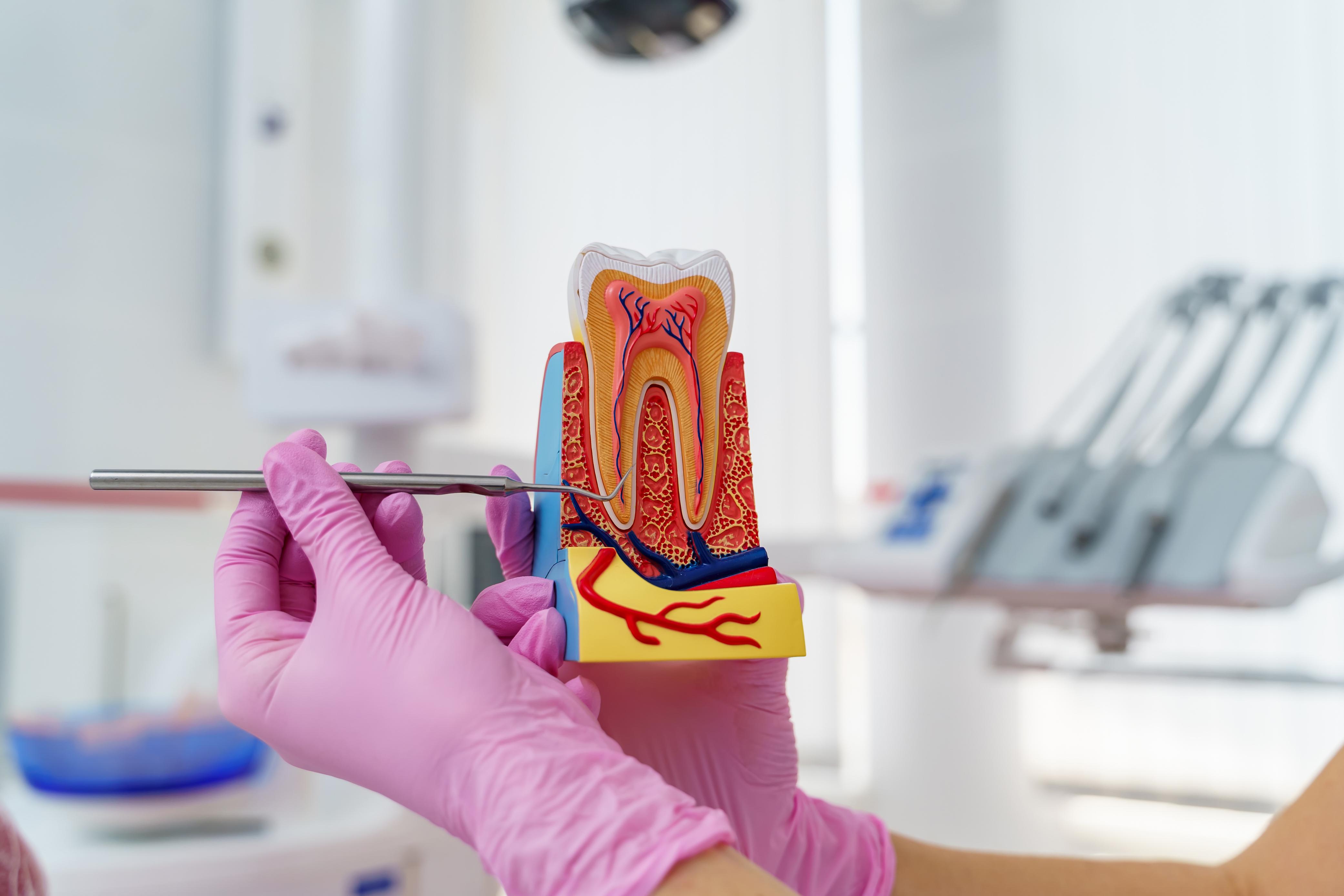 Affordable root canal treatment in Changanassery