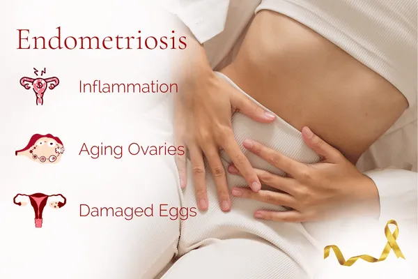 Endometriosis - New Research