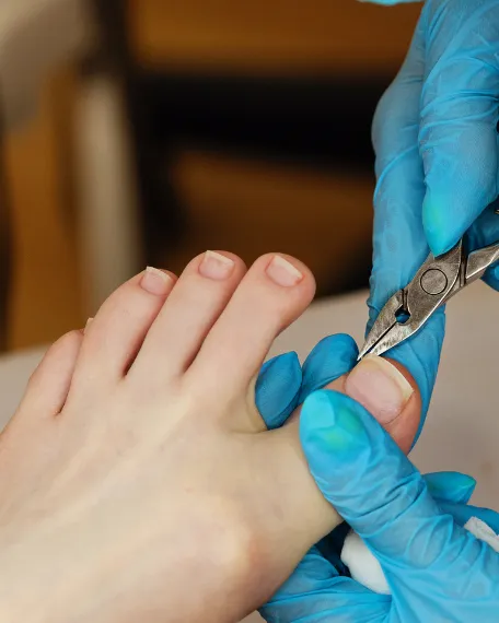 Toenail Trimming