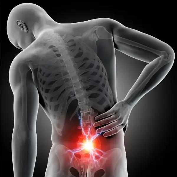 Back pain Platinum Health Solutions chiropractic