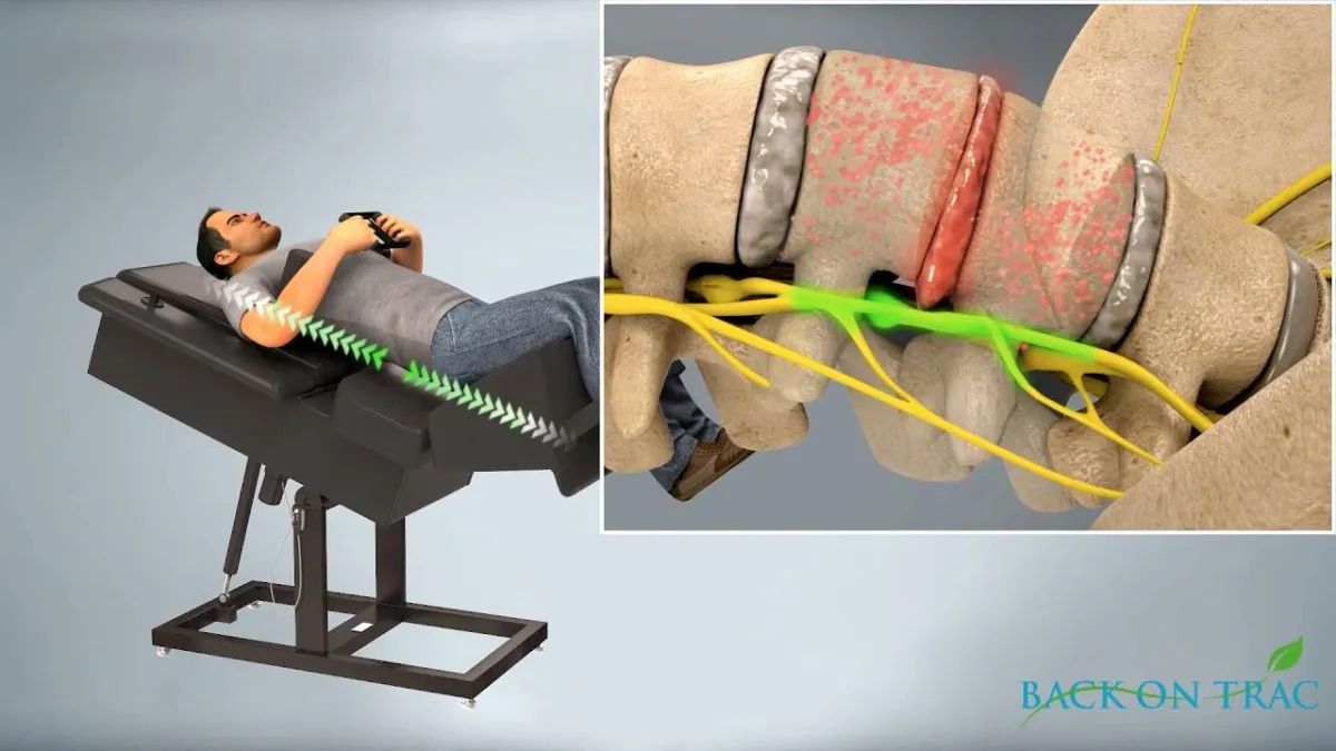 how spinal decompression works