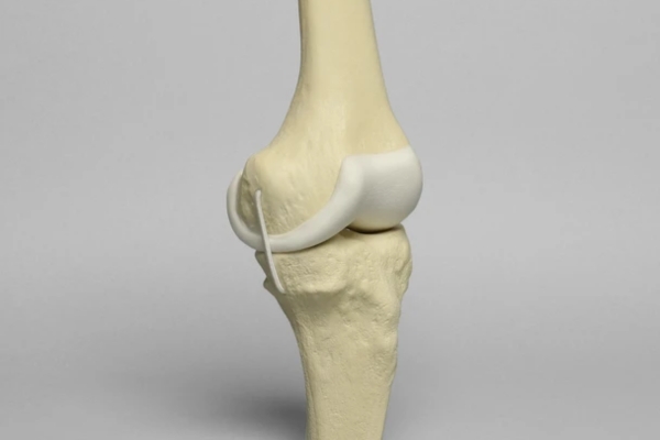 knee cartilage regeneration