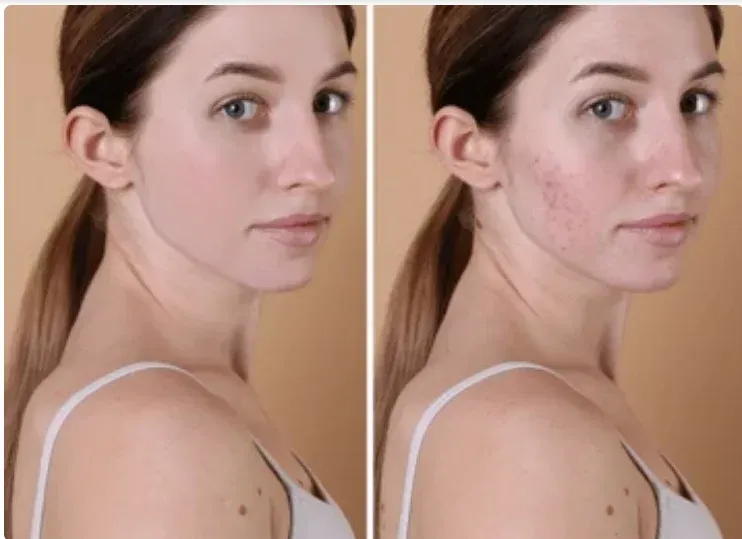 primebiome supplement