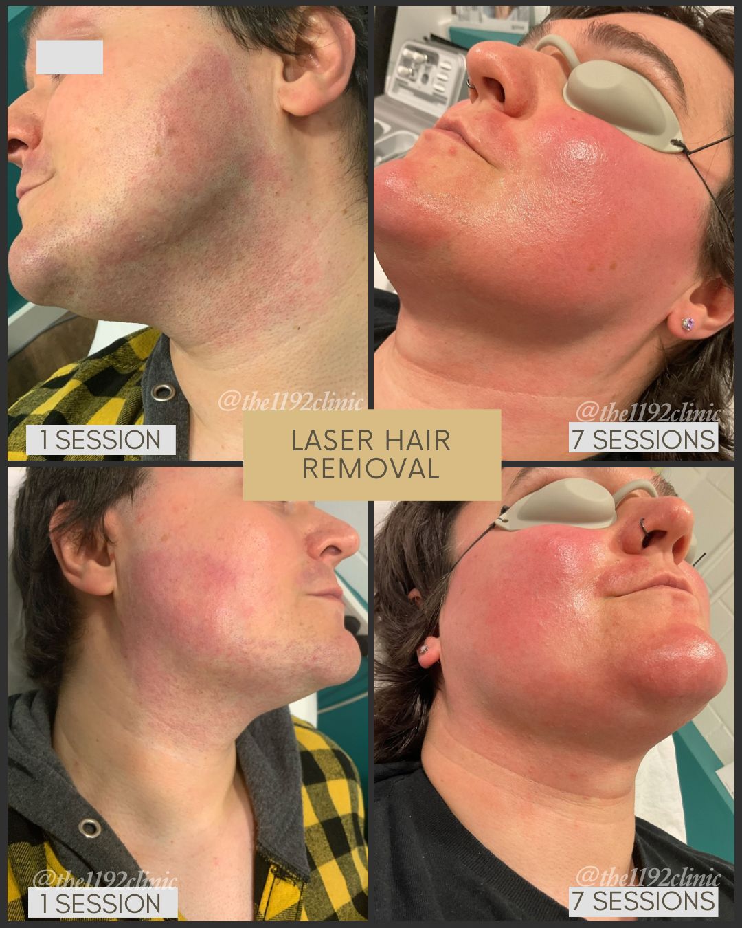 blue and black helmet on blue and white textile