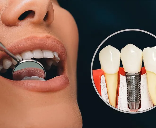 Natural Teeth