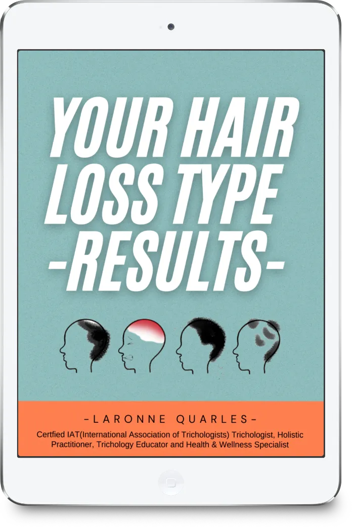 Your Hair Loss Type Results by LaRonne Quarles