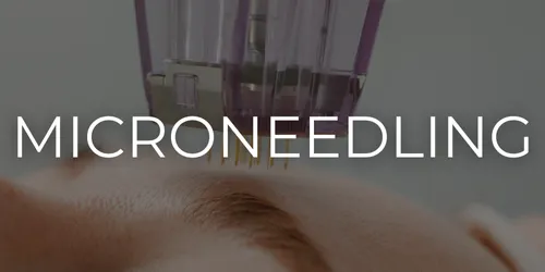 Microneedling treatment performed at Bowerman Artistry as part of a skincare membership in Elkhart Indiana