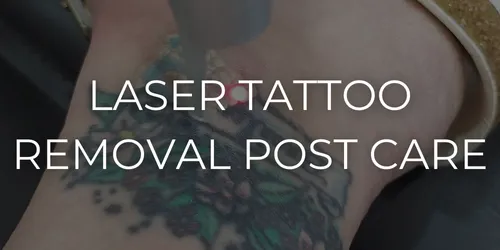 Laser tattoo removal post care of how to take care of your tattoo in Northern Indiana