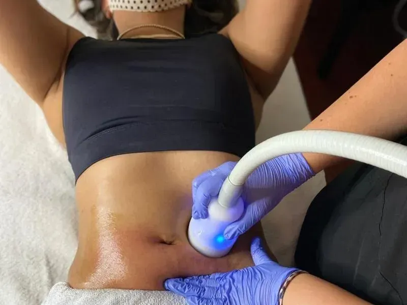 Cryo slimming treatment in Portland OR for fat reduction