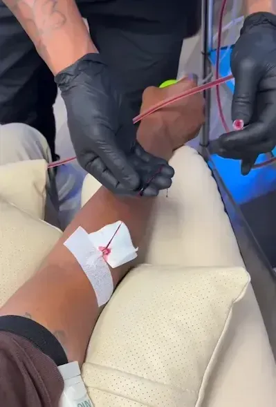 Medical professional preparing IV access lines on patient arm for Long COVID blood cleanse therapy