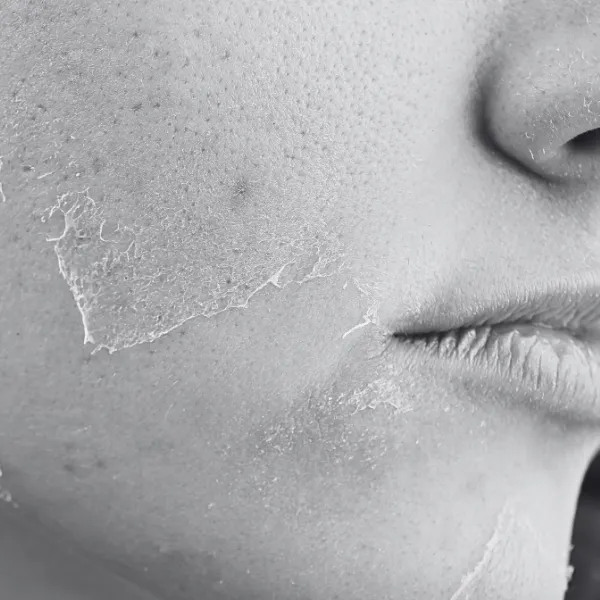 Uneven tone and texture
