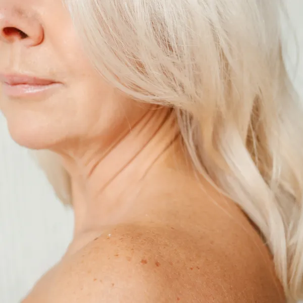 Sun Damage Removal in Roswell