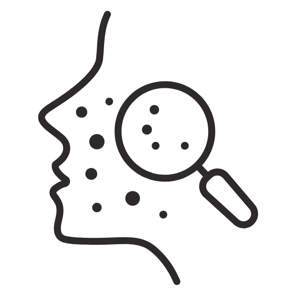 Targets stubborn breakouts