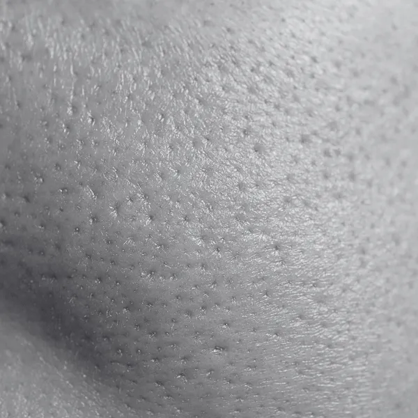 Large pores