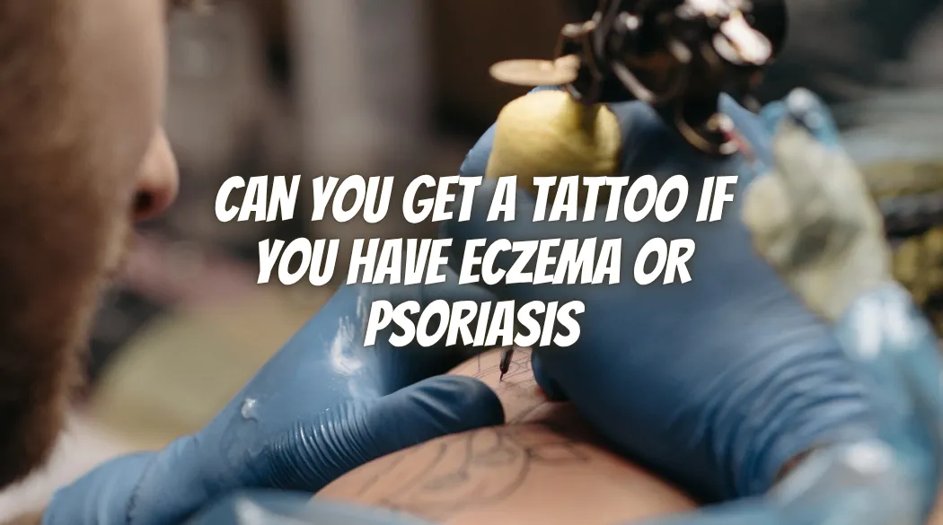 Can You Get a Tattoo If You Have Eczema or Psoriasis