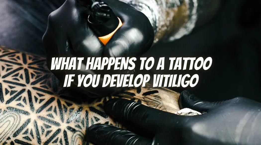 What Happens to a Tattoo If You Develop Vitiligo
