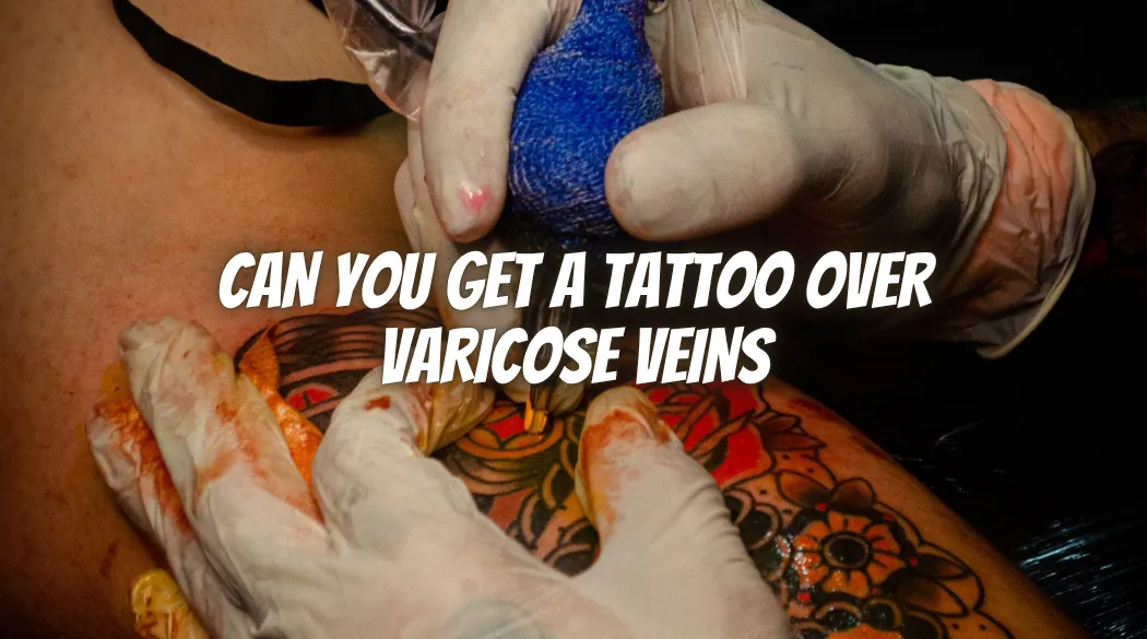 Can You Get a Tattoo Over Varicose Veins