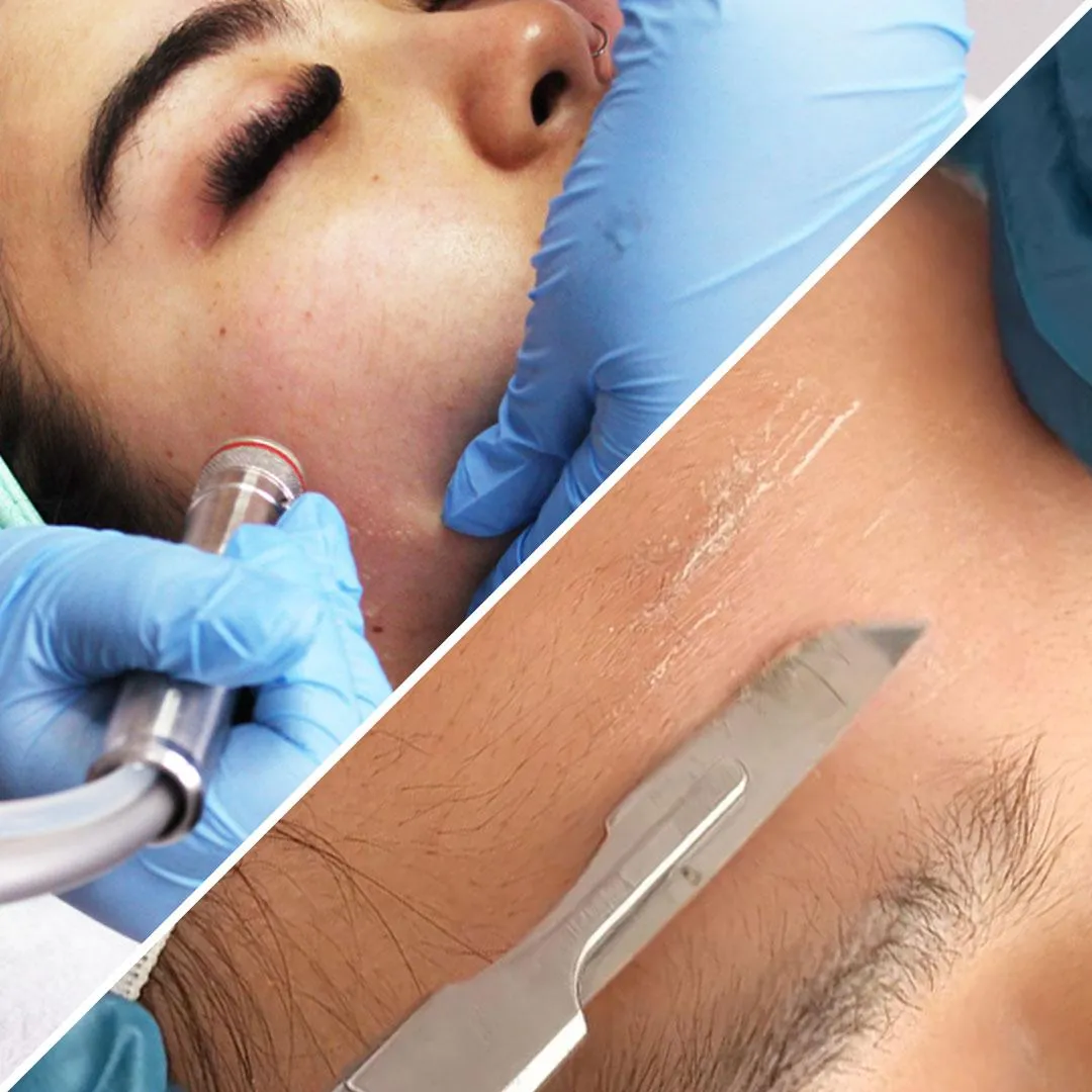 free dermaplaning with hydro facial
