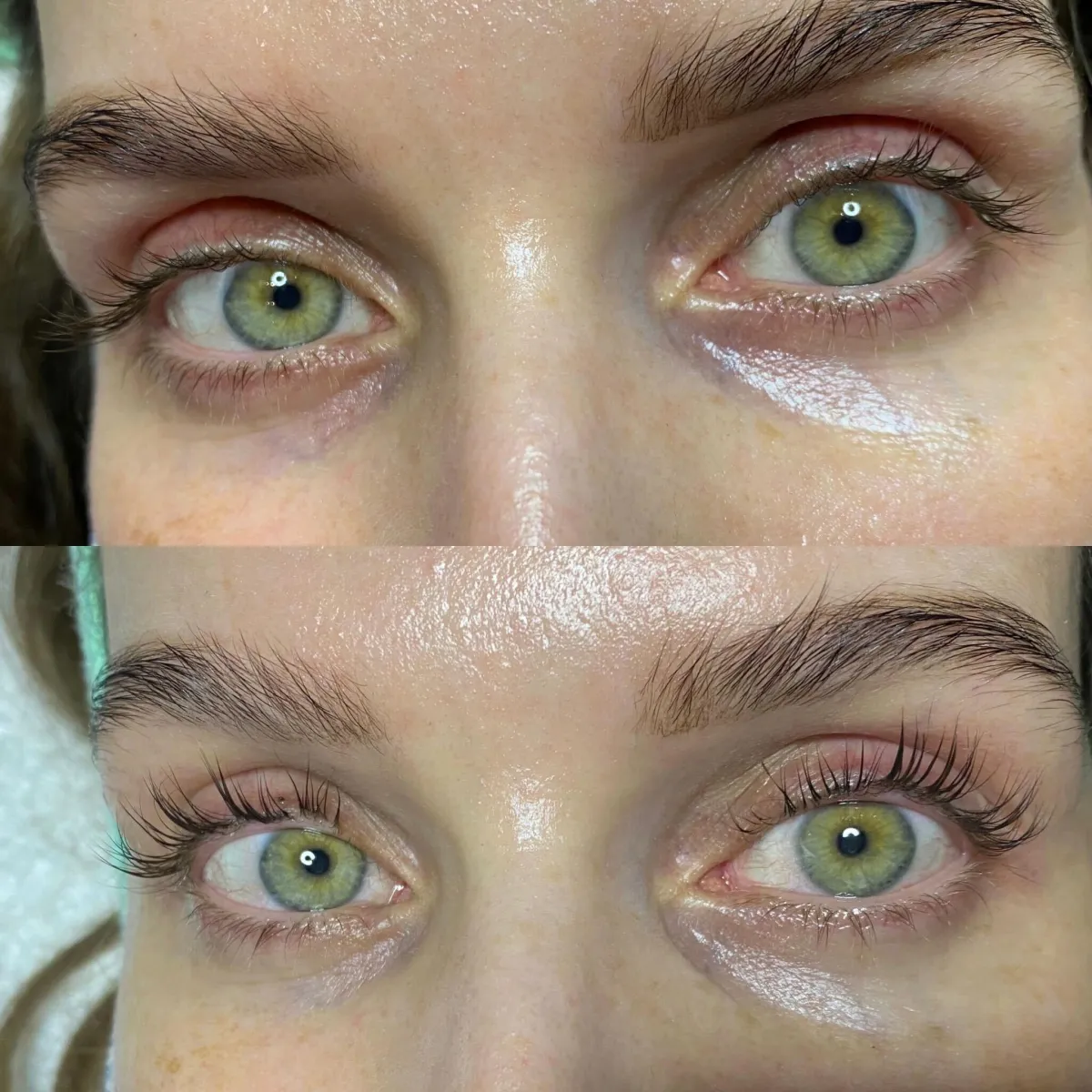 free dermaplaning facial with hollywood white teeth whitening pakage