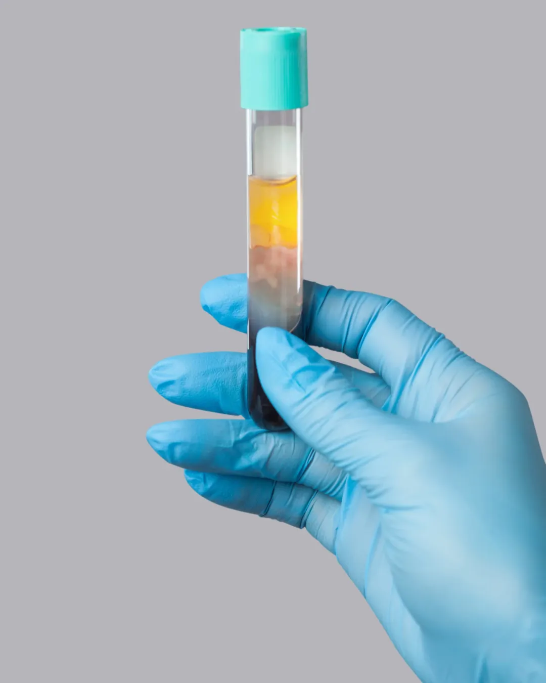 Orange flower with water droplets on petals